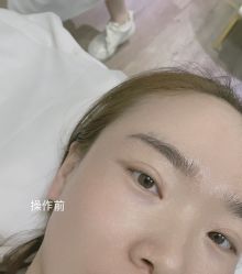 -MISS STAR·半永久纹眉·发际线·美瞳线