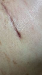 -上海伊莱美医疗美容医院