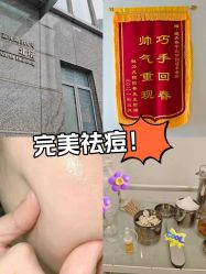 -塑青春&伊肤泉祛痘皮肤管理