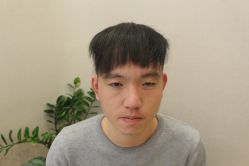 -大麦微针植发丨全国连锁