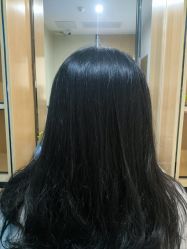 -雍禾植发