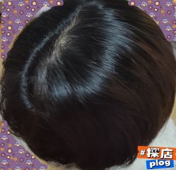 -黑奥秘脱发白发中心