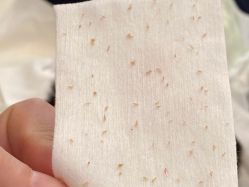 -成都苗方清颜专业祛痘