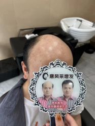 -唐风采假发补发定制