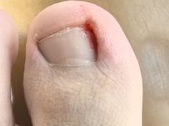 -郑远元专业修脚房·按摩·肉刺·灰指甲(新亭路店)