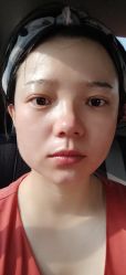 体验后-坤如玛丽·医疗美容中心