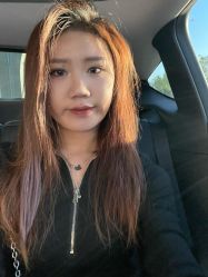 体验后-丰联丽格医疗美容·联合丽格眼整形中心