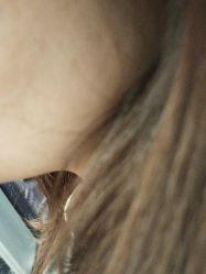 -美瑞莎创美医疗美容