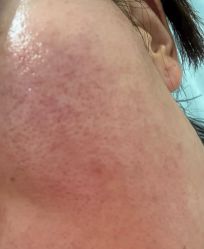 点击看大图 -南京医科大学友谊整形外科医院