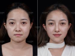 点击看大图 -北京漾格医疗美容医院