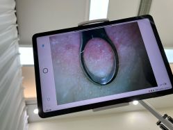 -凡碧诗毛孔清洁收细