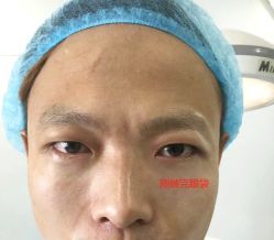 -天津健丽·去眼袋医疗美容机构