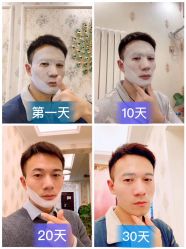 -凡碧诗毛孔收细