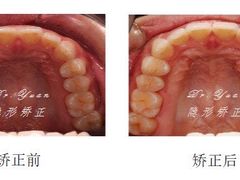 -Dr.Z dental仁康种植矫正中心