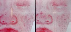 -苑苑vbeauty科技美容SPA