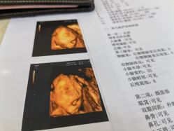-艾博尔医院