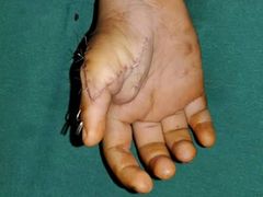 -华中科技大学同济医学院附属协和医院(主院区)