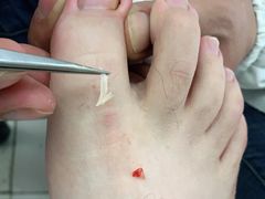 -新甲连锁灰指甲·甲沟炎·鸡眼(黑龙江路店)