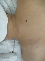 点击看大图 -苑苑vbeauty科技美容SPA
