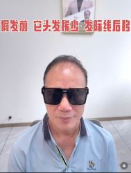 -唐风采假发补发定制