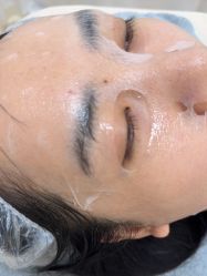 -长沙雅美医疗美容医院