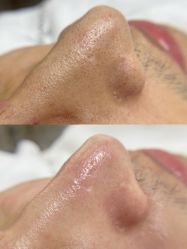 点击看大图 -美肤盾祛痘·问题肌头疗管理中心