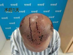 -雍禾植发全国连锁