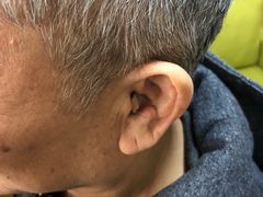 -北京悦听品牌助听器集合店峰力奥迪康斯达克瑞声达(石景山店)