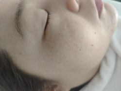 体验后-康美贞·痘肌养护管理中心