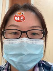 体验前-北京爱育华医院-医疗美容科