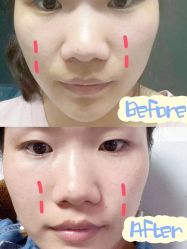 -伊美尔医疗美容医院