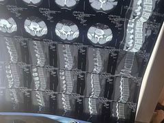 -张钰强中医正骨推拿连锁(华发商都店)