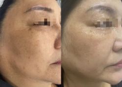 -Cream88颜皮肤管理中心