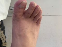 -新甲连锁灰指甲·甲沟炎·鸡眼(黑龙江路店)