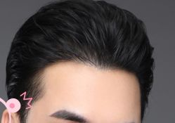 -大麦微针植发丨全国连锁