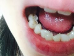 -爱贝口腔·牙周诊疗·种植修复中心