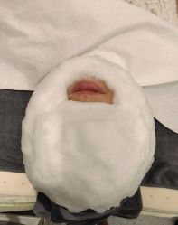 -苗方清颜·祛痘皮肤管理