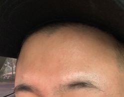 -八大处整形