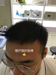 点击看大图 -大麦微针植发全国连锁