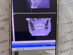 -土豆口腔(凤凰北总店)