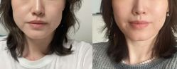 -Dr.U博士医疗美容医院