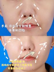 -弘美医美·艾维岚童颜抗衰中心