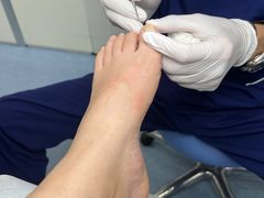-Andrew指甲专科灰指甲·甲沟炎矫正·3D步态矫形鞋垫定制(上海法华镇路旗舰店)
