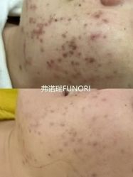 -春田皮肤管理中心品牌旗舰店