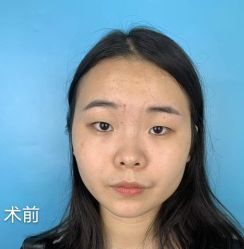 -广州健丽·去眼袋医疗美容机构