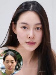 -Yestar重庆艺星医疗美容医院