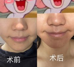 -慕颜医疗美容·皮肤微整 抗衰