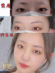 点击看大图 -OnFaer.纹眉半永久无创洗眉