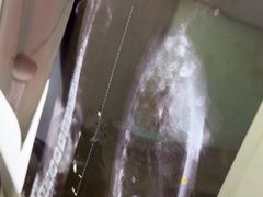 -张钰强中医正骨推拿连锁(华发商都店)