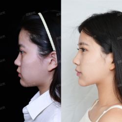 -上海玫瑰医疗美容医院